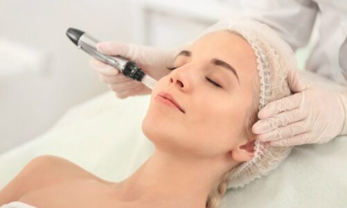 What You Need To Know About Collagen Bio Stimulation