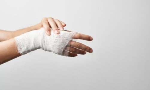 Understanding Minor Fractures and How to Address Them