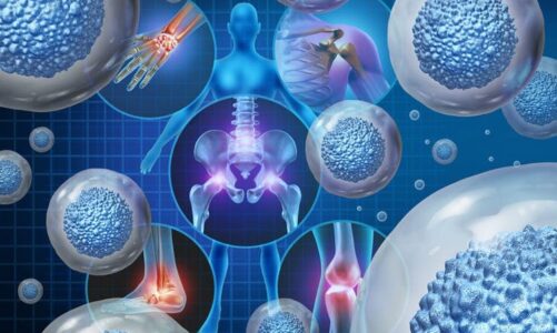 Who Is an Ideal Candidate for Stem Cell Therapy?